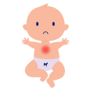 baby with chest congestion milk allergy symptoms