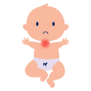 baby reflux milk allergy symptoms